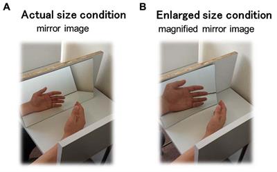 Factors associated with the modulation of pain  by visual distortion of body size